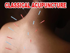 Classical Acupunture